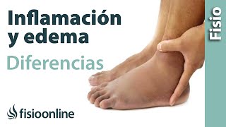 Inflamación y edema  Diferencias y características [upl. by Malim]