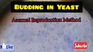 Budding in Yeast  Slide of Yeast Asexual Reproduction Method [upl. by Jerrilyn]