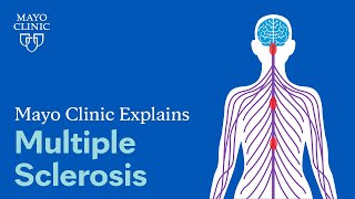 Mayo Clinic Explains Multiple Sclerosis [upl. by Ainahpets620]