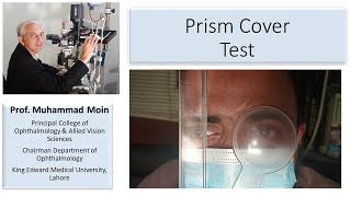 How to Perform Prism Cover Test [upl. by Sinegold]