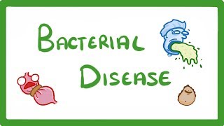 GCSE Biology  What Are Bacterial Diseases  Treatment and Prevention 37 [upl. by Piks]