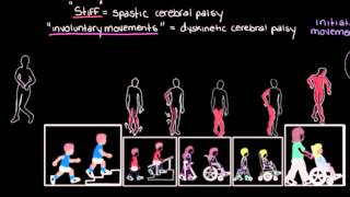 Khan Academy  Types of Cerebral Palsy Part 2 Dyskinetic amp Ataxic [upl. by Ahsiri]