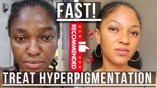 How To Effectively Treat Hyperpigmentation  understaning hyperpigmentation in the skin layers [upl. by Ailemaj]