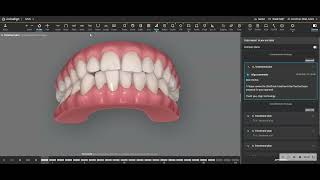 Interproximal Reduction with Invisalign is SAFE if planned properly [upl. by Pfaff]