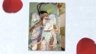 SEPTIC SHOCK 2 YEAR OLD ECMO SURVIVOR [upl. by Aicire]