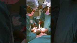 Classic Cardiac surgery❤️ youtube doctor perfusion cardiacsurgery [upl. by Yong83]