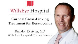 Corneal CrossLinking  Treatment for Keratoconus [upl. by Aniluj]