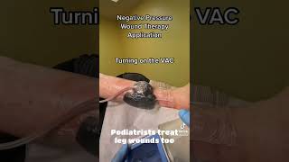 Podiatrists Treat Leg Wounds Too [upl. by Nisior]