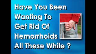 How To Remove Hemorrhoids [upl. by Langer899]