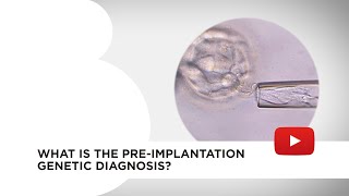 Preimplantation genetic diagnosis PDG [upl. by Noslen]