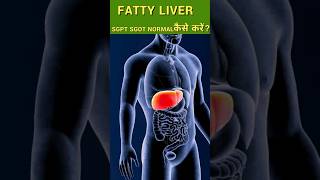 how to reverse fatty liver  SGPTSGOT कैसे कम करें fattyliver fattylivertreatment [upl. by Lorou373]