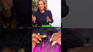 Thinning hair and balding around the hairline 😭hairsolution hairmakeover homeremedies [upl. by Anilehcim552]