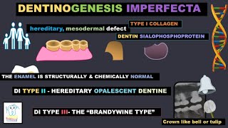 Dentinogenesis Imperfecta [upl. by Rosenberg]