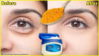 Home remedies for removing dark circles [upl. by Darcia]