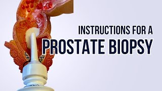 Instructions for Prostate Biopsy [upl. by Lunetta]