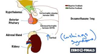 Understanding The Dexamethasone Suppression Test [upl. by Safoelc]