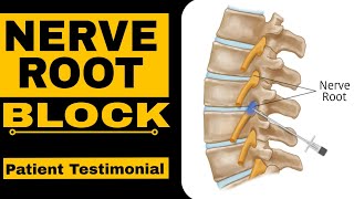 Nerve Root Block Patient Testimonial [upl. by Sorilda964]