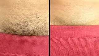 Permanently Remove Pubic Hair Instantly Using Natural Cream [upl. by Bora155]