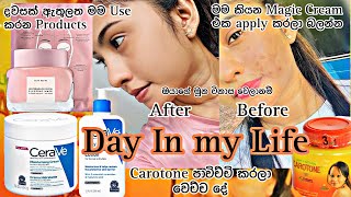 මූන විනාස වෙලානම් මෙන්න Magic Cream එකක්😱Carotone පාවිච්චි කරන්න හිතන් ඉන්න අයට🫣Day in my Life 🦋 [upl. by Ignatzia]