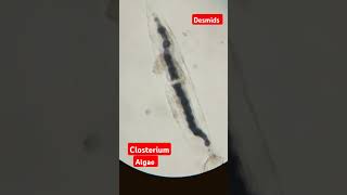 Closterium algae view under microsporeDesmidsMsc Botanypractical mscbotany botany shorts [upl. by Neyud]