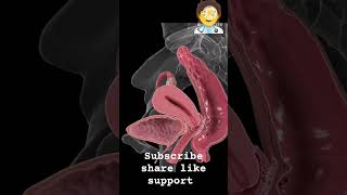 endometriosis shortsfeed youtubeshorts shorts [upl. by Aguste203]