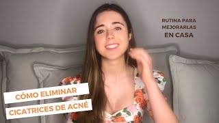 CÓMO ELIMINAR CICATRICES DE ACNÉ  La mejor RUTINA para CICATRICES de ACNÉ [upl. by Eninahpets]