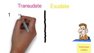 Edema Pathology Part  3 Hemodynamics Transudate versus Exudate Fmge Neet PG usmle Pathology Notes [upl. by Macdougall]