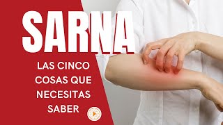 SARNA  Las 5 cosas que necesitas saber [upl. by Marti]