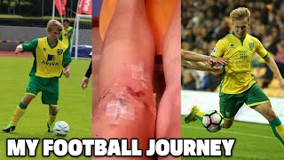 Becoming A Professional Footballer  ACL Surgery Being Released amp Academy Truth My Pro Journey [upl. by Nylekcaj]