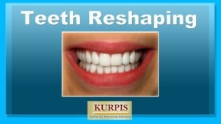 Teeth Reshaping [upl. by Portwin]