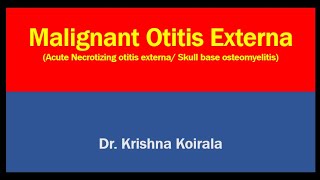 Malignant Otitis Externa  Skull Base Osteomyelitis  Invasive Otitis Externa [upl. by Eudo]