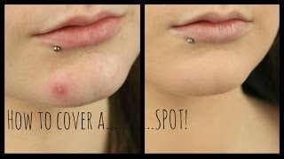 How To Cover A SpotBlemish [upl. by Ydnes666]