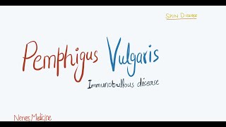 Pemphigus Vulgaris  clinical features pathophysiology and histology  immunobullous skin disease [upl. by Dnumsed456]