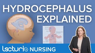 Hydrocephalus  Definition Symptoms and Nursing Interventions  Lecturio Nursing Pediatrics [upl. by Peony]