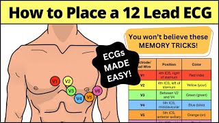 12 Lead ECG Placement MADE EASY EMT Nursing Paramedic ecg nursing [upl. by Cahilly]