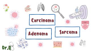 Carcinoma vs Adenoma vs Sarcoma  little differences  Cancertumor MyClinicalBook [upl. by Zetnwahs580]