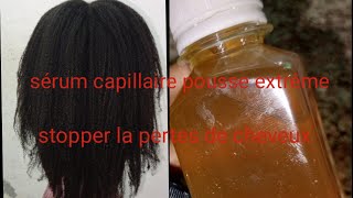 SÉRUM CAPILLAIRE POUSSE CHEVEUX STOPPER LA PERTES DE CHEVEUX 😭😱 [upl. by Anitnegra]