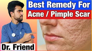 Best Remedy Treatment for acne pimple scar … Dr Friend [upl. by Guss885]