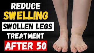 How To Treat Swollen Legs 5 Powerful Drinks That Works Reduce Swelling After 50 [upl. by Calida]