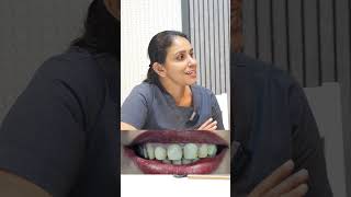 Dental veneers procedure for smile correction dentalexperience [upl. by Assira121]