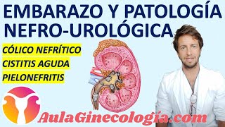 EMBARAZO Y PATOLOGÍA UROLÓGICA CÓLICO CISTITIS PIELONEFRITIS  Ginecología y Obstetricia [upl. by Eisler]