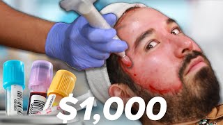 I Got A 1000 Blood Facial [upl. by Salome]