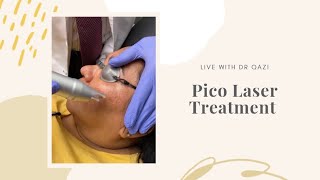 Pico Laser Treatment For Melasma LIVE [upl. by Brouwer625]