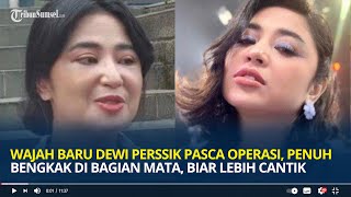 Wajah Baru Dewi Perssik Pasca Operasi Penuh Bengkak di Bagian Mata Biar Lebih Cantik [upl. by Hodges]