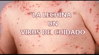 LA LECHINA UN VIRUS DE CUIDADO [upl. by Digirb]