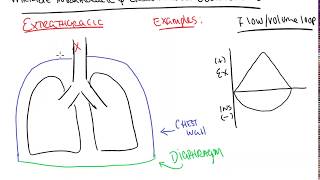 Variable intra and extra thoracic obstructions [upl. by Narahs368]