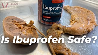 What Ibuprofen Does to the Body [upl. by Milurd]