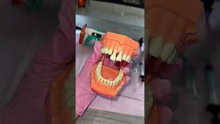 Férula para traumatismo dental [upl. by Bremble]