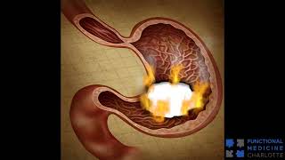 GERD Acid Reflux and Heartburn  who what when why where and how to get rid of it [upl. by Macdonell]