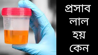 প্রস্রাব বা মুত্র লাল হবার কারন Urine infections symptoms [upl. by Anivlem]